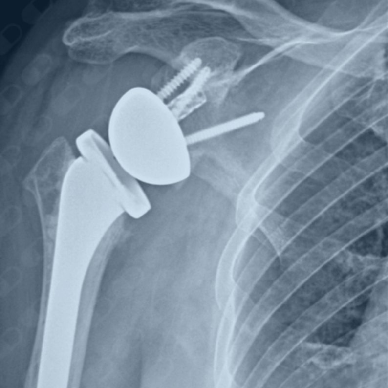 Imagem de radiografia analisada em detalhe